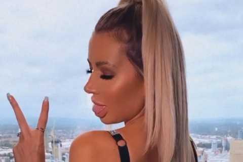 Olivia Attwood flashes her bottom as she gets a bum lift for upcoming hen do to ‘keep it peachy’