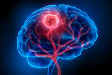 Major breakthrough as cancer patients have chemo for brain tumours for first time