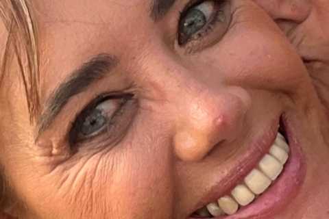 I’m 52 and thought I was too old for zits – but squeezing it led to the discovery I had cancer