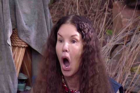 Janice Dickinson QUITS I’m A Celebrity after horror accident that left her ‘in agony and gushing..