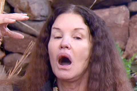 Janice Dickinson breaks silence after quitting I’m A Celeb as dramatic night fall that left her in..