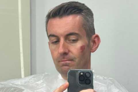 BBC Newsreader left with ‘messed up face’ after horror accident as make-up team scramble to cover..