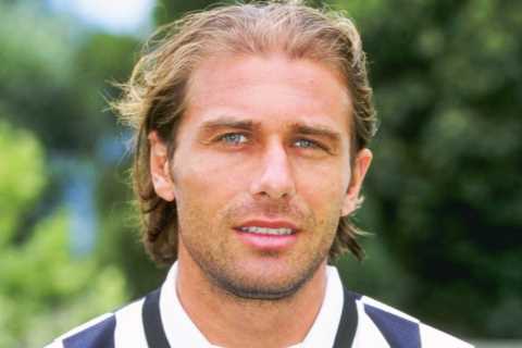 I’m a hair transplant doctor for Premier League stars – the procedure can change their lives and..