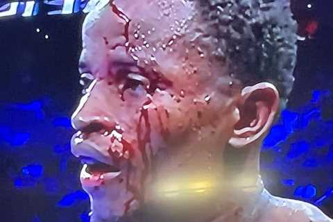 Boxing match STOPPED after fighter suffers horror head injury as he is left with blood pouring down ..