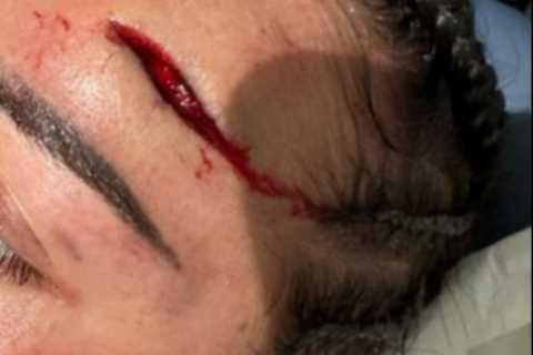 Boxing stunner Cherneka ‘Sugar Neekz’ Johnson puts gruesome head injury behind her as she prepares..