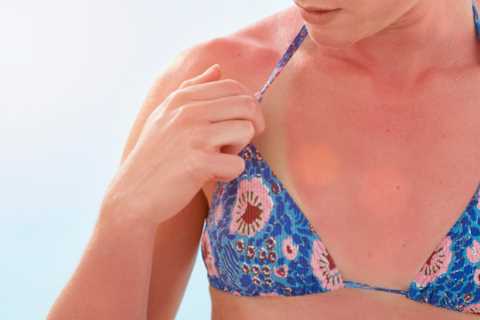 I’m a GP – taking 4 common skin treatments ‘increases your risk of deadly cancer’