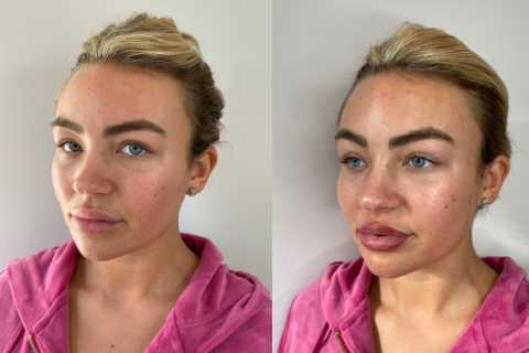 Towie’s Ella Rae Wise shows off results of her £600 lipstick tattoo after getting lip filler..