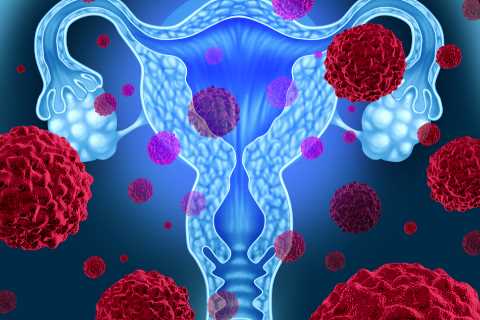 The ‘silent’ cervical cancer symptom you can feel in your back – and 8 other signs