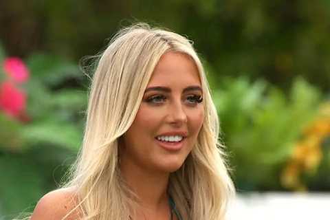 I’m a celebrity dentist and Love Island’s turkey teeth trend is so unhealthy