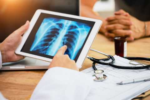 Major lung cancer screening change could catch 9,000 cases EARLY each year – here’s who’ll be..