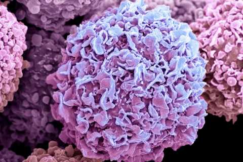 Shock closure of major cancer charity threatens search for new life-saving treatments
