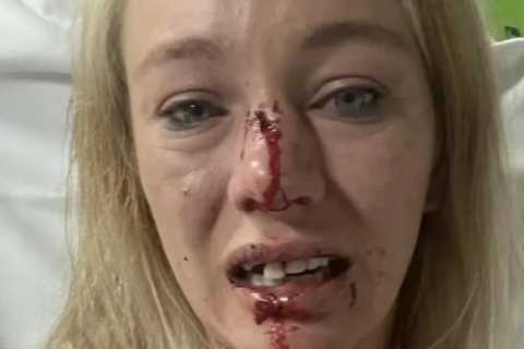 Jockey’s face smashed in with rock in horrific carjacking outside her house just three weeks before ..