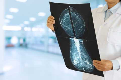 AI could slash cancer waiting times – HALVING the workload of NHS medics