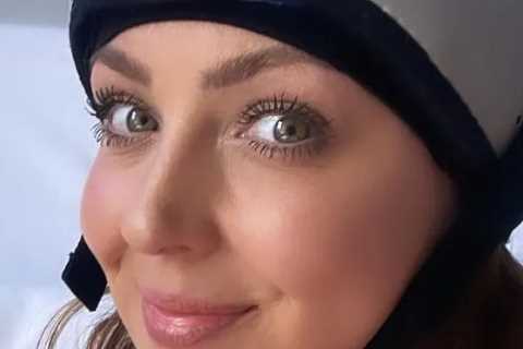 Strictly Come Dancing’s Amy Dowden shares ‘heartbreaking’ hair loss as she gives health update in..