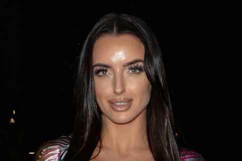 Love Island Star Amy Day Rushed to Hospital After Painful Accident