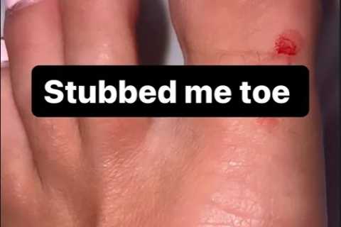 Chloe Ferry Celebrates 28th Birthday in Ibiza with a Painful Injury