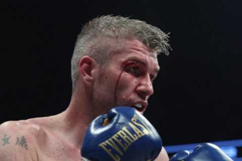 Liam Smith shows off horror cut above eye after ten-round beatdown by Chris Eubank Jr