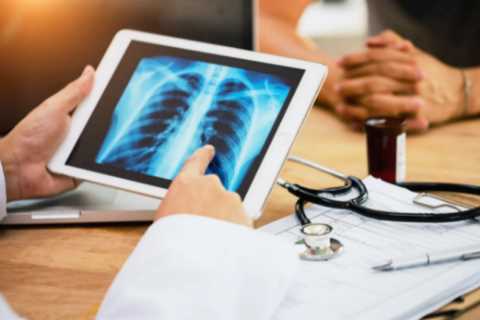 Over 1 Million Smokers to Receive Free Lung Cancer Checks on NHS