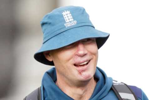 Freddie Flintoff grins as he bravely shows his scars – as insiders say it’s the ‘perfect time for a ..