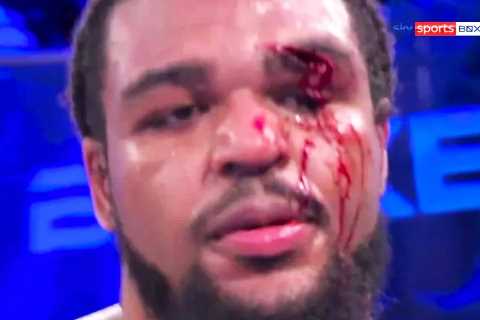 Brit boxing up-and-comer Jamie TKV left covered in blood with gruesome eye injury in brutal shock..