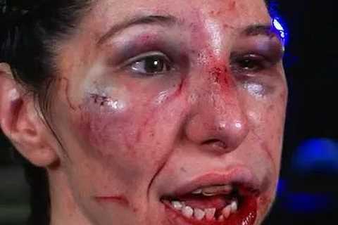 Bare-Knuckle Boxer Left Unrecognizable with Horrific Injuries After Brutal Fight