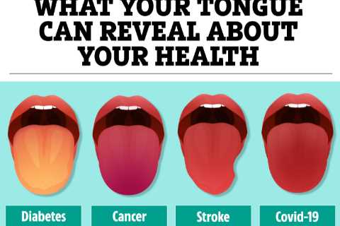 The 5 things your tongue can reveal about your health