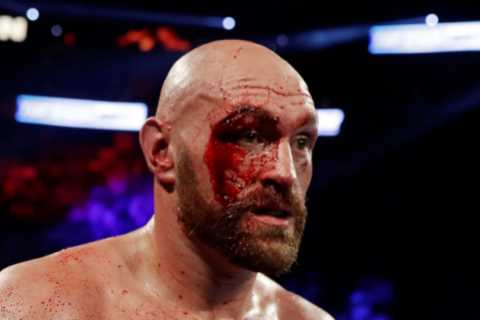 Tyson Fury Sends Money to Cut Man Who Saved His Career