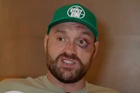 Tyson Fury at Risk of Forced Fight with Oleksandr Usyk Despite Battered Face