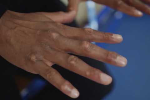 Anthony Joshua Shows Off Gruesome Scars After Street Fight