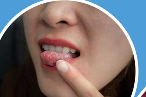 The Subtle Sign of Mouth Cancer You Can Hear – and 3 Other Red Flag Symptoms