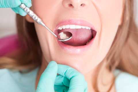 Mouth cancer deaths surge 46% amid fears lack of NHS dentists means thousands of cases are missed