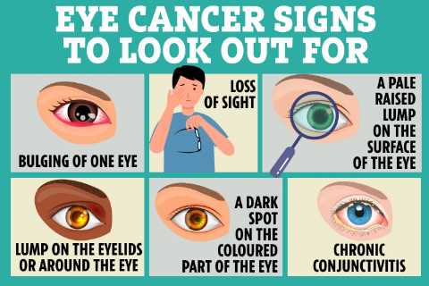 The first signs of cancer you might spot in your eyes – from floaters to blurred vision