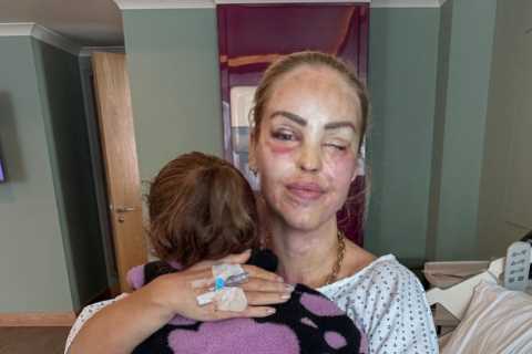 Katie Piper undergoes surgery to save her eye and urges trolls to back off