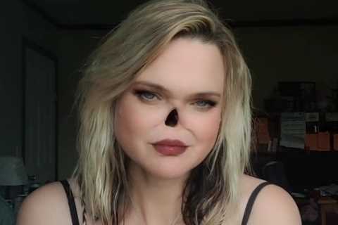 Mum Who Lost Nose to Cancer Ditches Prosthetic for New Look