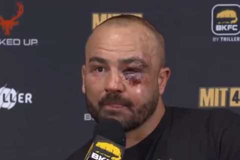 Former UFC Champion Eddie Alvarez Suffers Horror Facial Injuries in Bare-Knuckle Boxing Defeat