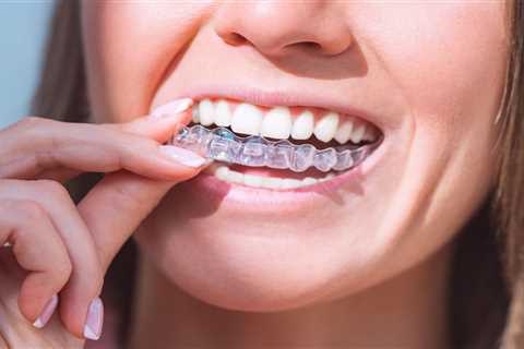 Hundreds of Brits Face Dental Nightmare as Smile Direct Club Closes Down