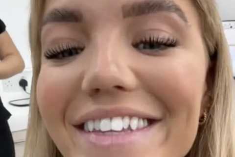 Love Island Star Molly Smith Faces Backlash for Dental Transformation
