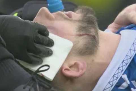 Everton Star James Tarkowski Suffers Gruesome Eye Injury During Villa Match