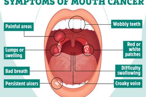 How to Check Your Mouth for Signs of Cancer – Simple Self-Examination Guide