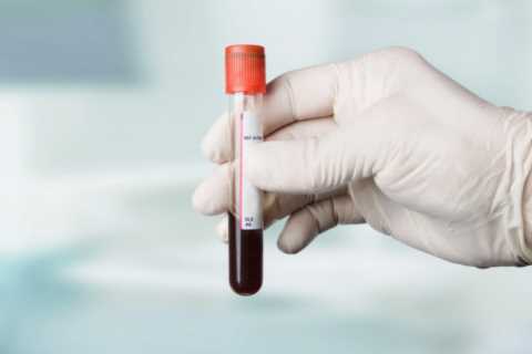 Thousands of Brits 'at risk of cancer but don't know it' – and could be eligible for new test,..