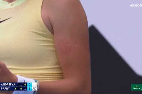 Australian Open Star Mirra Andreeva, 16, Reveals Gruesome Scars After Biting Her Own Arm in Anger..