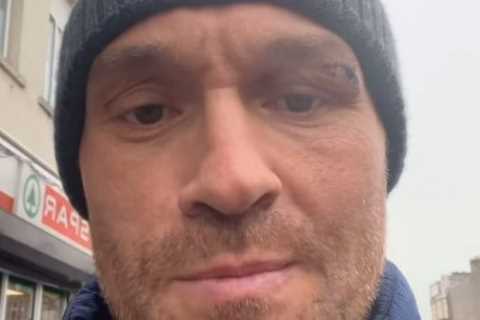 Tyson Fury flaunts gruesome eye cut after postponing fight with Oleksandr Usyk