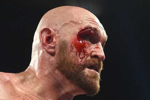Tyson Fury's Vulnerability Revealed: Otto Wallin Speaks Out