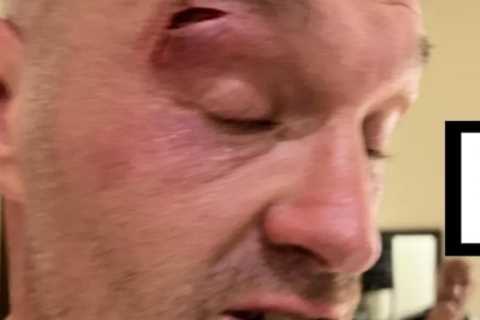 Joseph Parker addresses Tyson Fury cut conspiracy theories that delayed fight with Usyk