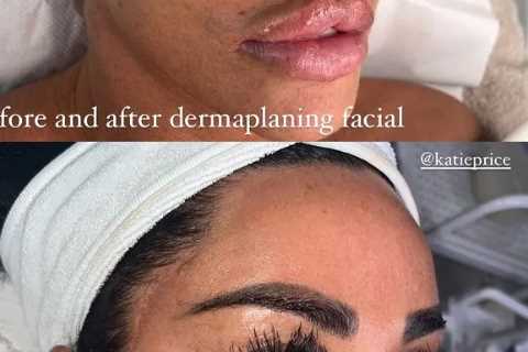 Katie Price flaunts her fuller lips post age-defying facial treatment