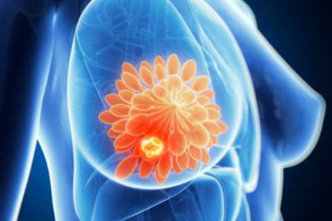 Breast cancer breakthrough: Scientists discover how to kill 'hibernating' tumour cells