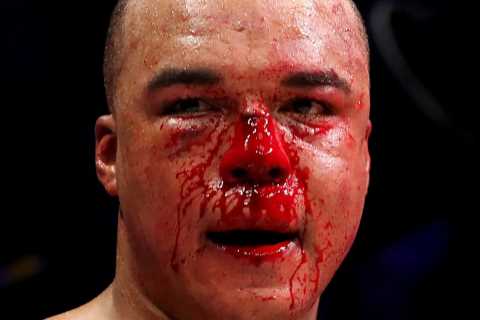 Fabio Wardley's Bloody Nose Described as 'Horror Show' in Savage Draw with Frazer Clarke