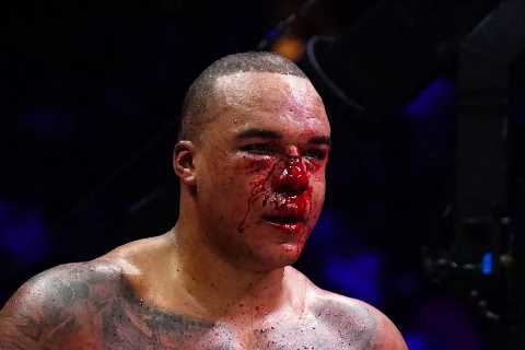Fabio Wardley Reflects on Bloodbath Draw with Frazer Clarke