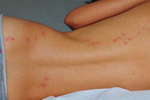 Three Budget-Friendly Ways to Get Rid of Bed Bugs and Sleep Soundly