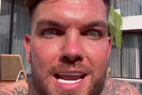 Furious Geordie Shore Star Claps Back at Trolls Over £6k Turkey Teeth